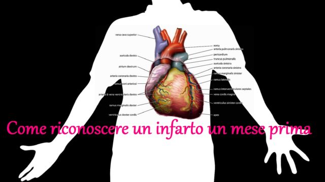 infarto