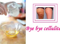 rimedi per combattere la cellulite