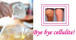 rimedi per combattere la cellulite