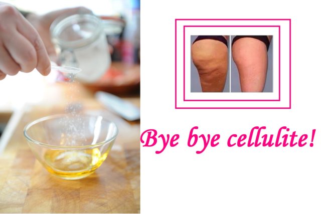 rimedi per combattere la cellulite