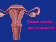 cancro ovarico