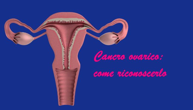 cancro ovarico