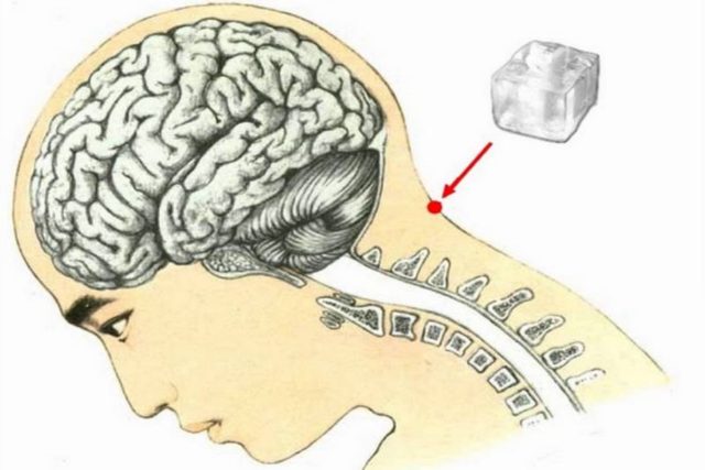 cubetto di ghiaccio tra testa e collo