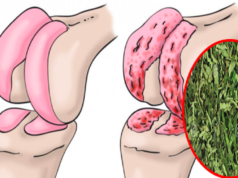 cartilagine di anca e ginocchia