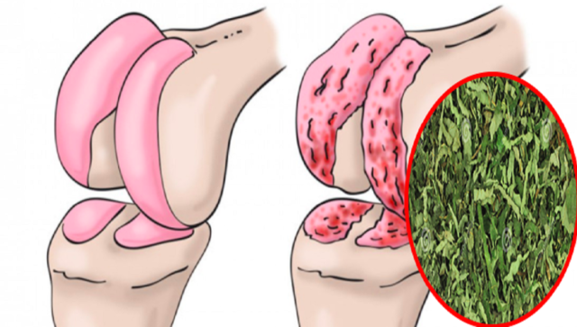 cartilagine di anca e ginocchia