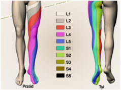 sciatalgia come curarla