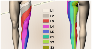 sciatalgia come curarla