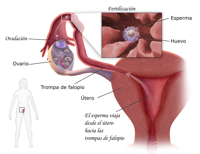 fibroma uterino