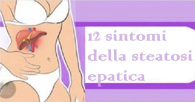 steatosi