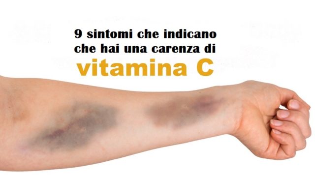 carenza di vitamina c