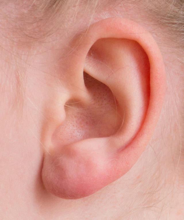test dell'udito