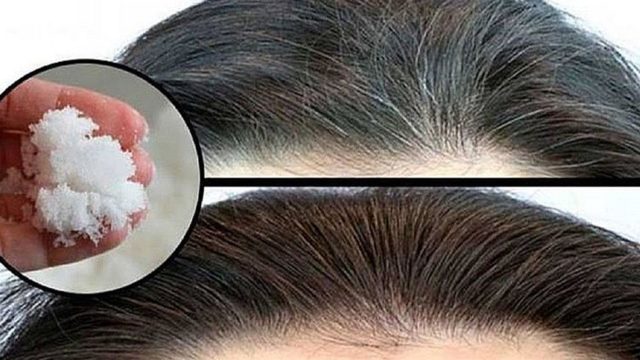 caduta dei capelli con il bicarbonato